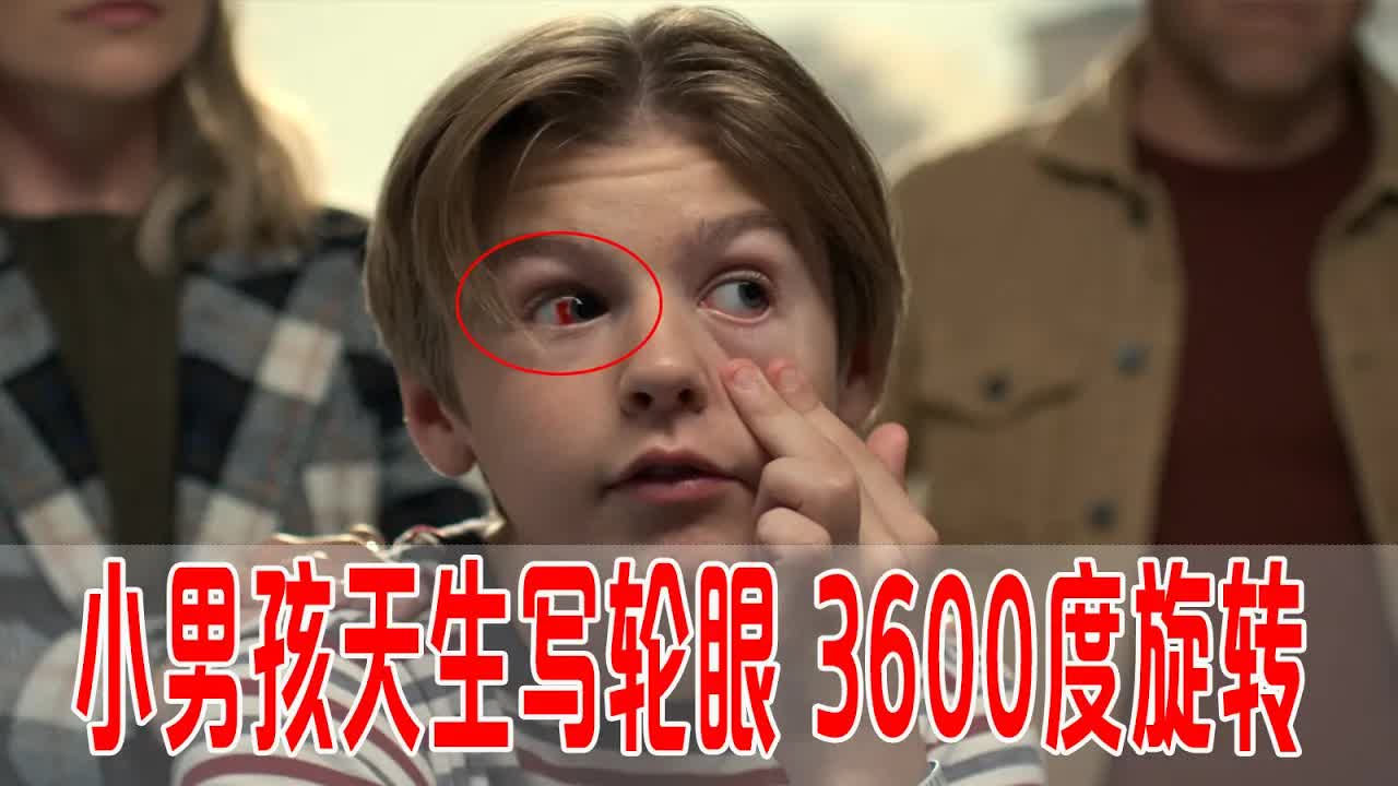 男孩天生写轮眼，能3600度旋转，却因使用过度，双目失明，看天才医生怎么救治？